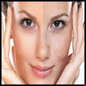 محصولات مراقبتی پوست